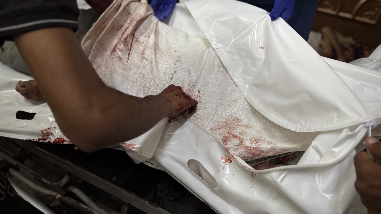 Foto - Şehit ve yaralılar var! Bu görüntülere yürek nasıl dayanır