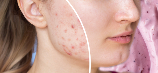 Foto - Şekeri bırakırsanız! Vücudunuza bunlar olacak