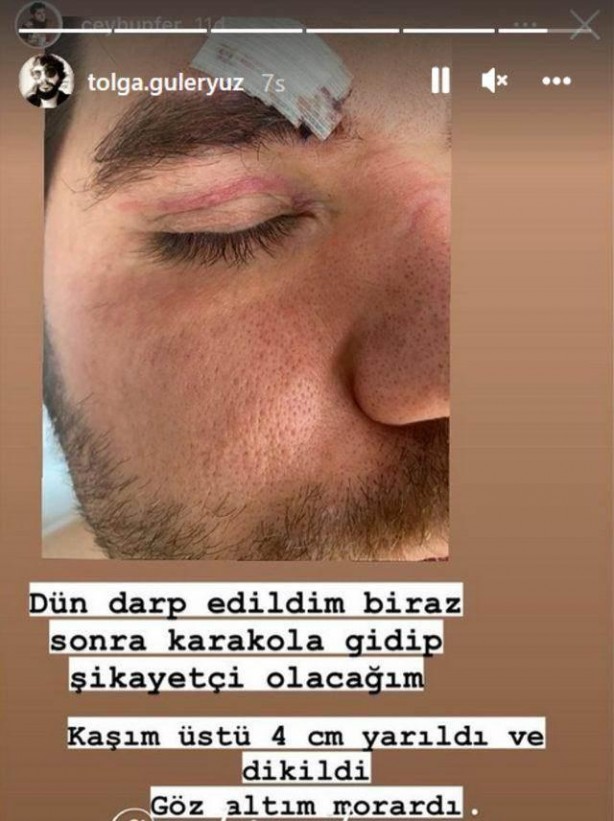 Foto - Seksenler dizisi oyuncusu şok oldu! Görüntüleri paylaştı