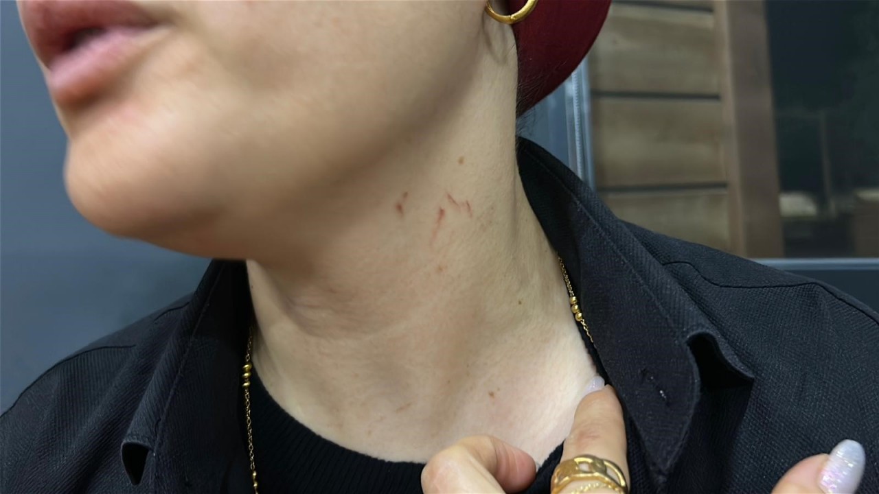 Foto - Seküler yaşam biçimi kadına dehşeti yaşattı! Alkol illeti düğünü karıştırdı