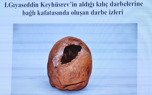 Foto - Selçuklu sultanlarının kemikleri DNA testi ile incelendi… Bilinenin aksine sonuçlar çıktı... Ölüm nedenleri hayrete düşürdü