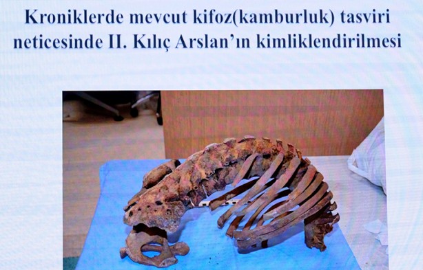 Foto - Selçuklu sultanlarının kemikleri DNA testi ile incelendi… Bilinenin aksine sonuçlar çıktı... Ölüm nedenleri hayrete düşürdü