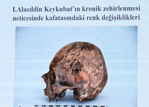 Foto - Selçuklu sultanlarının kemikleri DNA testi ile incelendi… Bilinenin aksine sonuçlar çıktı... Ölüm nedenleri hayrete düşürdü