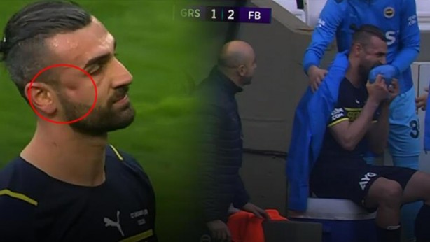 Foto - Serdar Dursun krizi! Elmacık kemiği kırıldı, hakem ve doktorlar araya girdi...