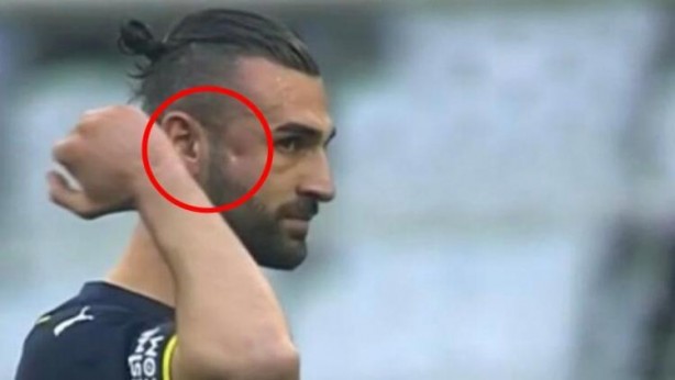 Foto - Serdar Dursun krizi! Elmacık kemiği kırıldı, hakem ve doktorlar araya girdi...