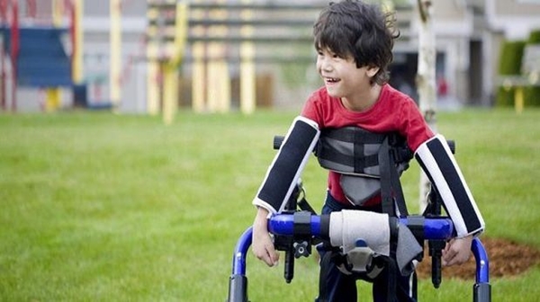 Foto - Serebral Palsi hastalığının belirtileri 