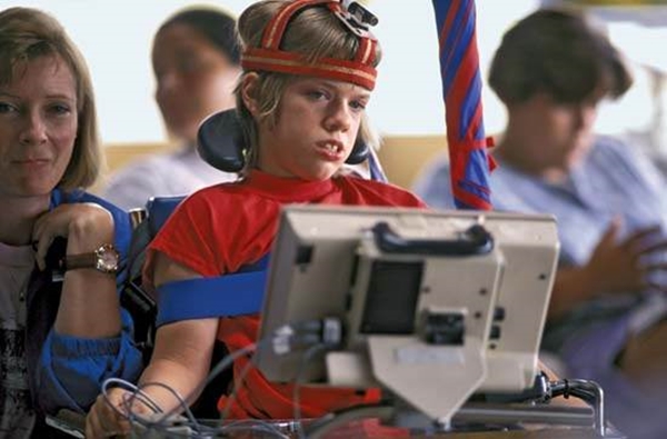 Foto - Serebral Palsi hastalığının belirtileri 