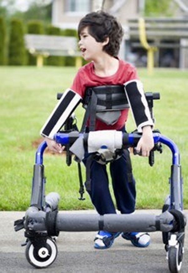 Foto - Serebral Palsi hastalığının belirtileri 