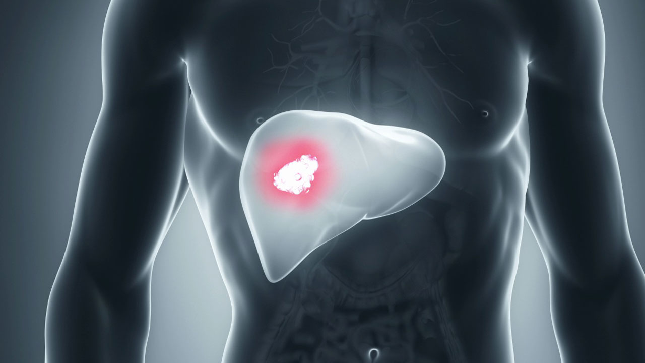 Foto - Sessiz pandemi büyüyor! Bu hastalık 2050'de rekor seviyeye ulaşacak