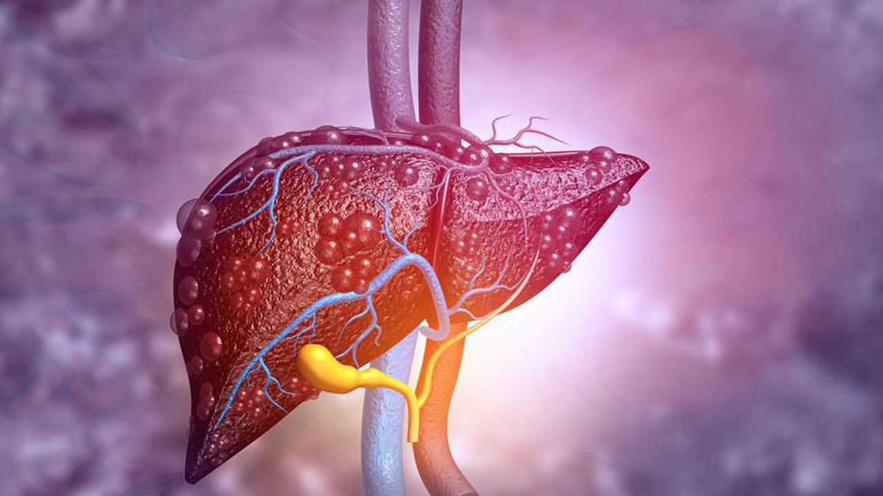 Foto - Sessiz pandemi büyüyor! Bu hastalık 2050'de rekor seviyeye ulaşacak