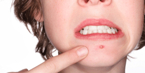 Foto - Sıcak suyun bilinmeyen faydaları