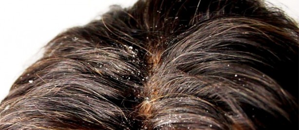 Foto - Sıcak suyun bilinmeyen faydaları