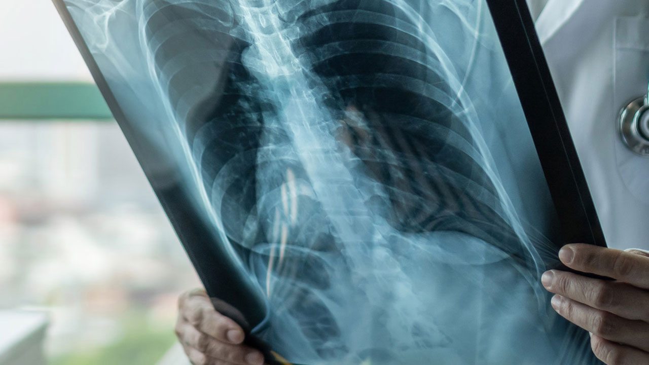 Foto - Sıcaklarda kurtarıcı gibi görünüyor… Akciğerlerinizi sessizce tehdit ediyor