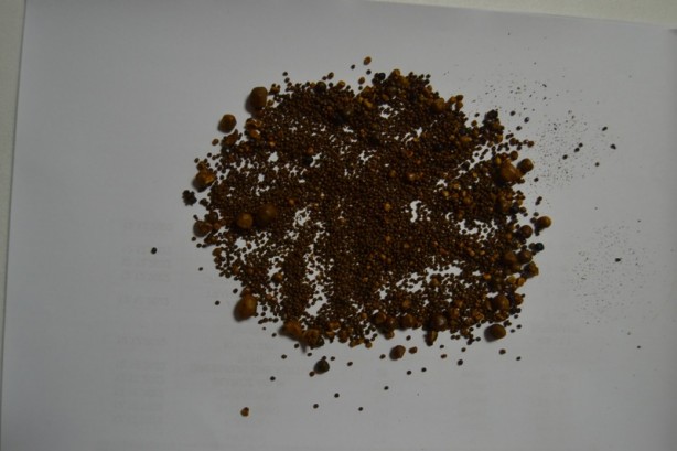 Foto - Şiddetli karın ağrısı şikayetiyle gitti! 4 bin 536 tane çıkarıldı