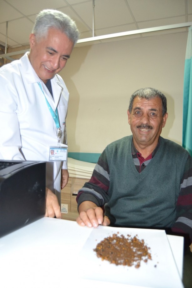 Foto - Şiddetli karın ağrısı şikayetiyle gitti! 4 bin 536 tane çıkarıldı