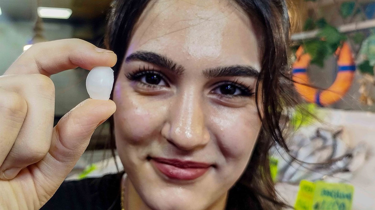 Foto - Şifalı olduğu düşünülüyor! Kendisi 650 TL, başındaki taş 10 bin TL