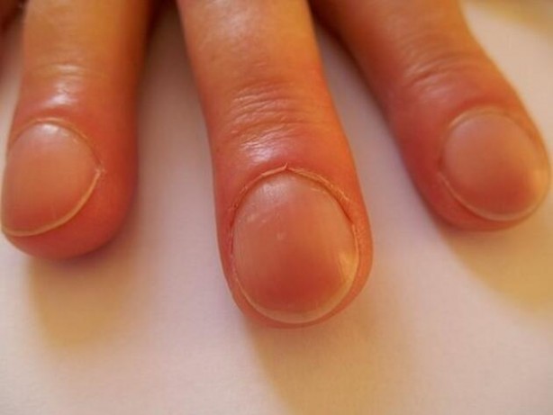 Foto - Sigara içenler dikkat! Bunları bilseydiniz bir kez daha düşünürdünüz