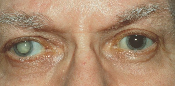 Foto - Sigara içenler dikkat! Bunları bilseydiniz bir kez daha düşünürdünüz