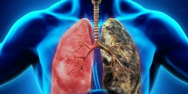 Sigara içenler dikkat! İşte akciğerleri temizleyen yiyecekler