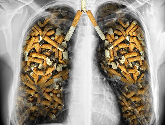 Foto - Sigara içenler dikkat! İşte akciğerleri temizleyen yiyecekler