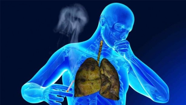 Foto - Sigara içenleri bekleyen büyük tehlike: KOAH