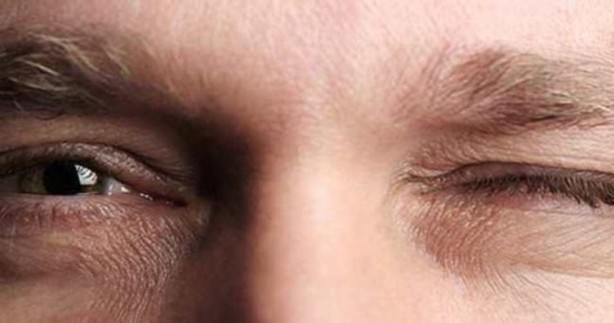 Foto - Sık sık gözleriniz seğiriyorsa dikkat! Ciddi sorunlara yol açıyor