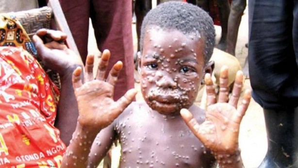 Foto - Simpsonlar filan hikaye! Yusuf Güney'in aylar önceki tahmini tuttu, herkes dehşete düştü