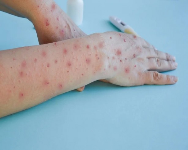 Foto - Simpsonlar halt etmiş! Maymun çiçeğini bilen Yusuf Güney'in son tahmini olay: 2025'te gelecekler