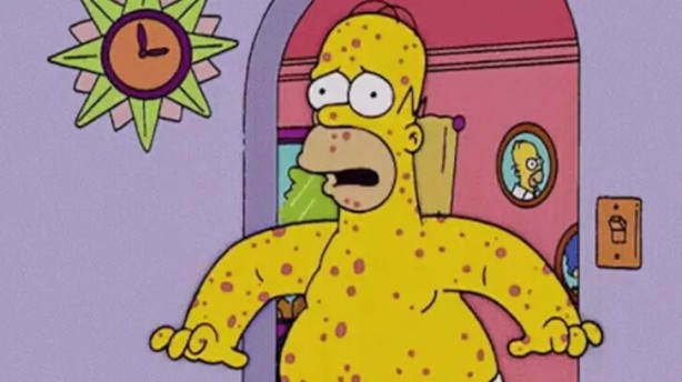 Foto - Simpsonlar'da dehşete düşüren maymun çiçeği virüsü sahnesi! İşte şimdi gerçekten yandık