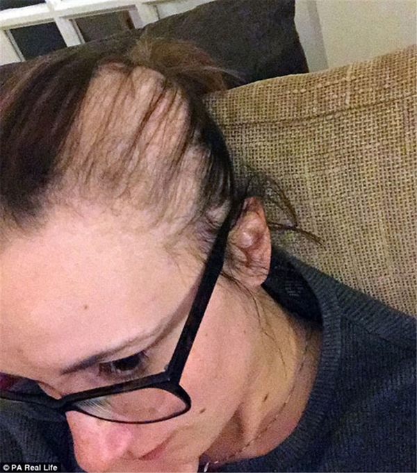 Foto - Sınav stresi bu hale getirdi!