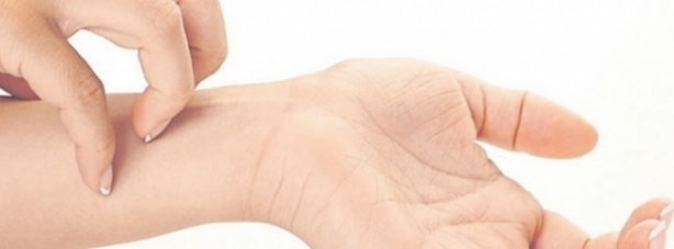  Sinek ısırığını geçirmek istiyorsanız...