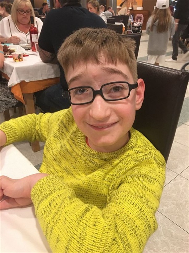 Foto - Sıra dışı olay! Beyni dışarıda doğdu!