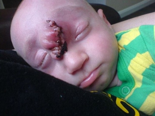 Foto - Sıra dışı olay! Beyni dışarıda doğdu!