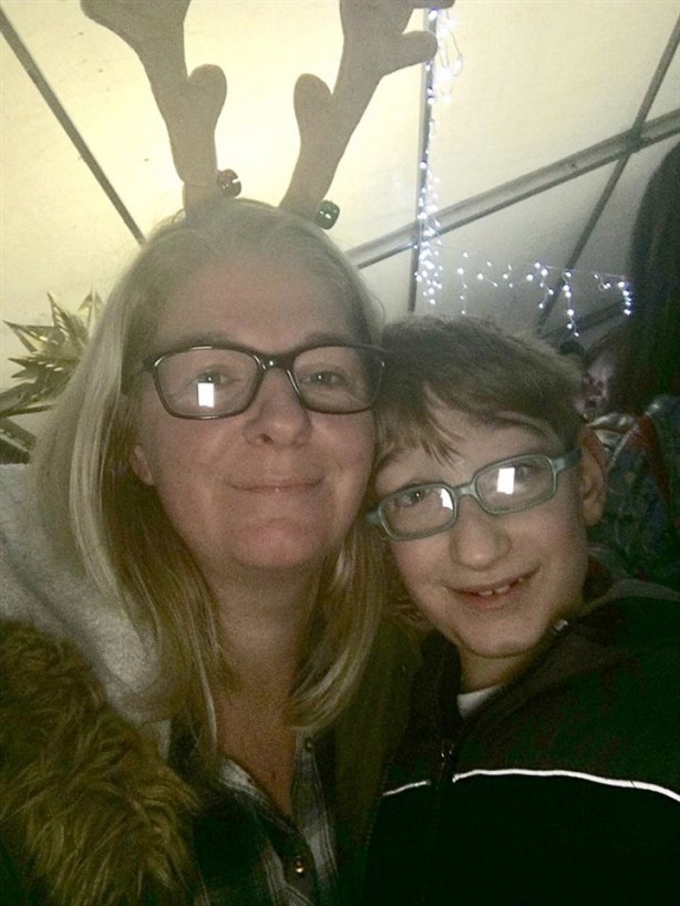 Foto - Sıra dışı olay! Beyni dışarıda doğdu!