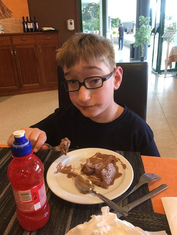 Foto - Sıra dışı olay! Beyni dışarıda doğdu!