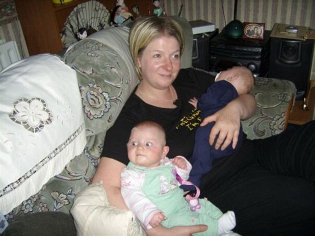 Foto - Sıra dışı olay! Beyni dışarıda doğdu!