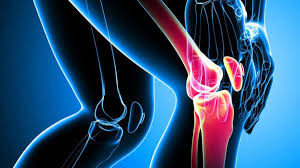 Foto - Sirke, zencefil ve biber karışımı ile diz, kemik ve eklem ağrısına son: Dudak uçuklattı! Adeta çakı gibi böyle oluyor