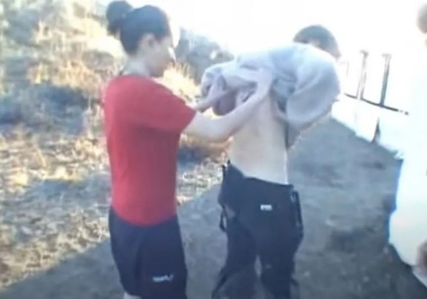 Sırtından çıkanlar görenleri şaşkına çevirdi! Sivilce zannettiği yaradan bakın ne çıktı