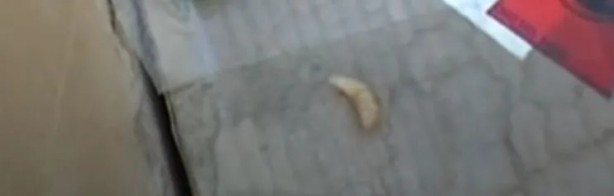 Foto - Sırtından çıkanlar görenleri şaşkına çevirdi! Sivilce zannettiği yaradan bakın ne çıktı