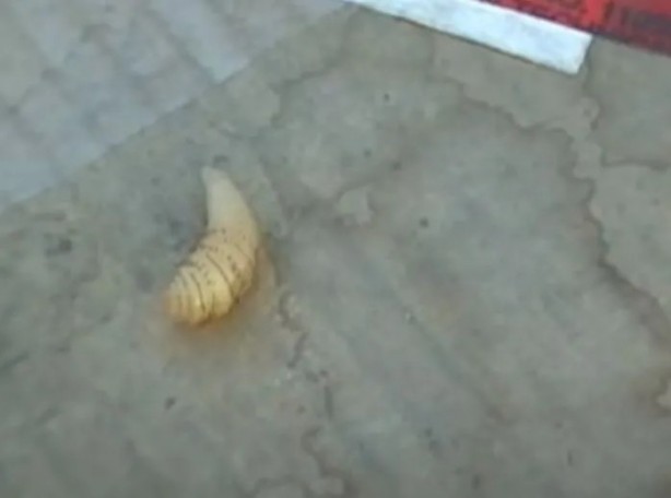 Foto - Sırtından çıkanlar görenleri şaşkına çevirdi! Sivilce zannettiği yaradan bakın ne çıktı