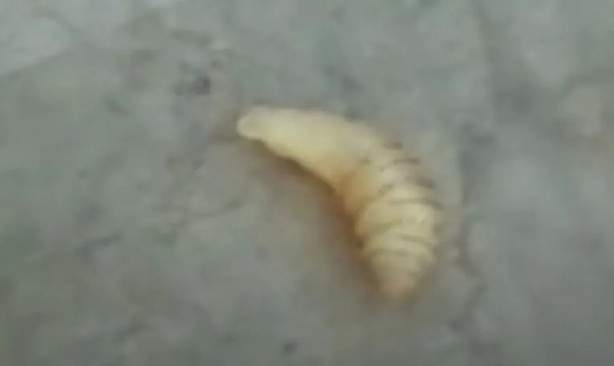 Foto - Sırtından çıkanlar görenleri şaşkına çevirdi! Sivilce zannettiği yaradan bakın ne çıktı