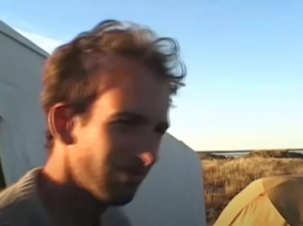 Foto - Sırtından çıkanlar görenleri şaşkına çevirdi! Sivilce zannettiği yaradan bakın ne çıktı