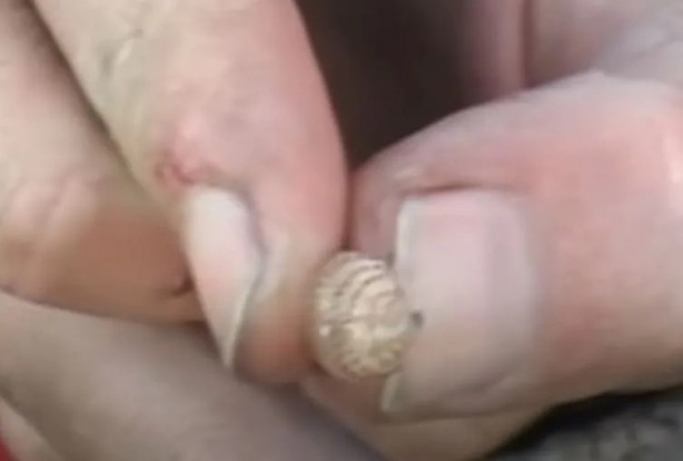 Foto - Sırtından çıkanlar görenleri şaşkına çevirdi! Sivilce zannettiği yaradan bakın ne çıktı