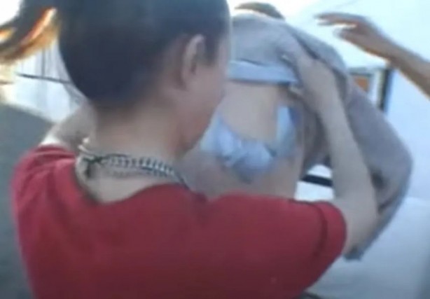 Foto - Sırtından çıkanlar görenleri şaşkına çevirdi! Sivilce zannettiği yaradan bakın ne çıktı