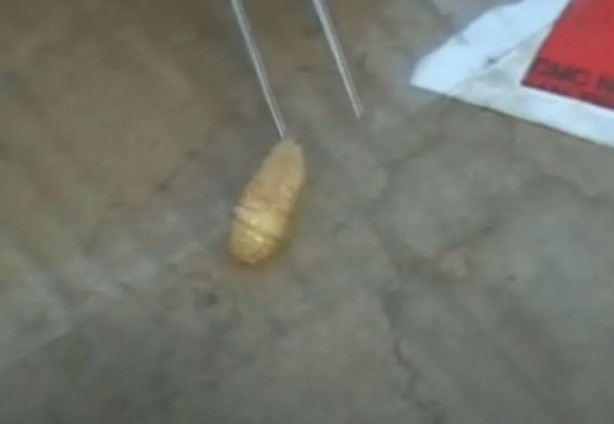 Foto - Sırtından çıkanlar görenleri şaşkına çevirdi! Sivilce zannettiği yaradan bakın ne çıktı