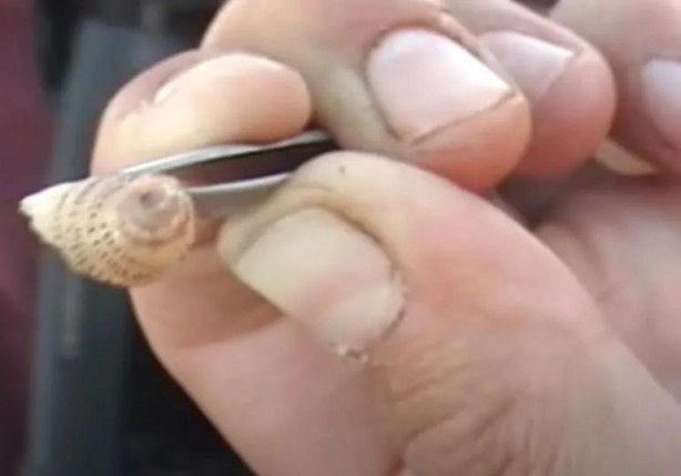 Foto - Sırtından çıkanlar görenleri şaşkına çevirdi! Sivilce zannettiği yaradan bakın ne çıktı