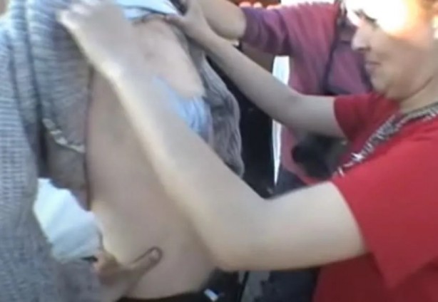 Foto - Sırtından çıkanlar görenleri şaşkına çevirdi! Sivilce zannettiği yaradan bakın ne çıktı