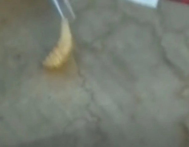 Foto - Sırtından çıkanlar görenleri şaşkına çevirdi! Sivilce zannettiği yaradan bakın ne çıktı