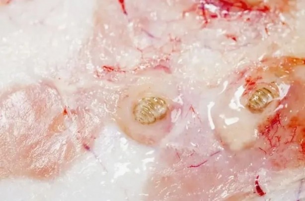 Foto - Sırtından çıkanlar görenleri şaşkına çevirdi! Sivilce zannettiği yaradan bakın ne çıktı