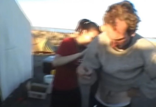 Foto - Sırtından çıkanlar görenleri şaşkına çevirdi! Sivilce zannettiği yaradan bakın ne çıktı